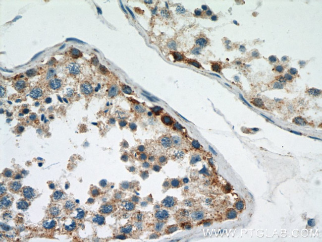 MRPL28 Antibody in Immunohistochemistry (Paraffin) (IHC (P))