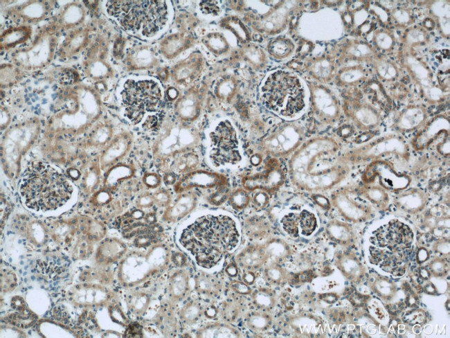 MRPL28 Antibody in Immunohistochemistry (Paraffin) (IHC (P))