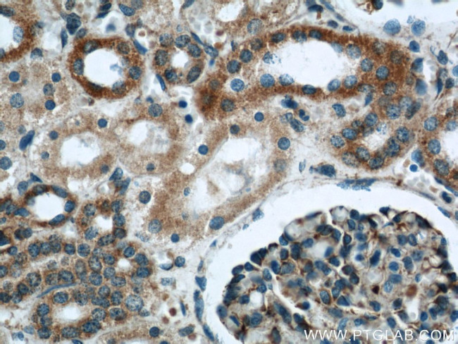 MRPL28 Antibody in Immunohistochemistry (Paraffin) (IHC (P))