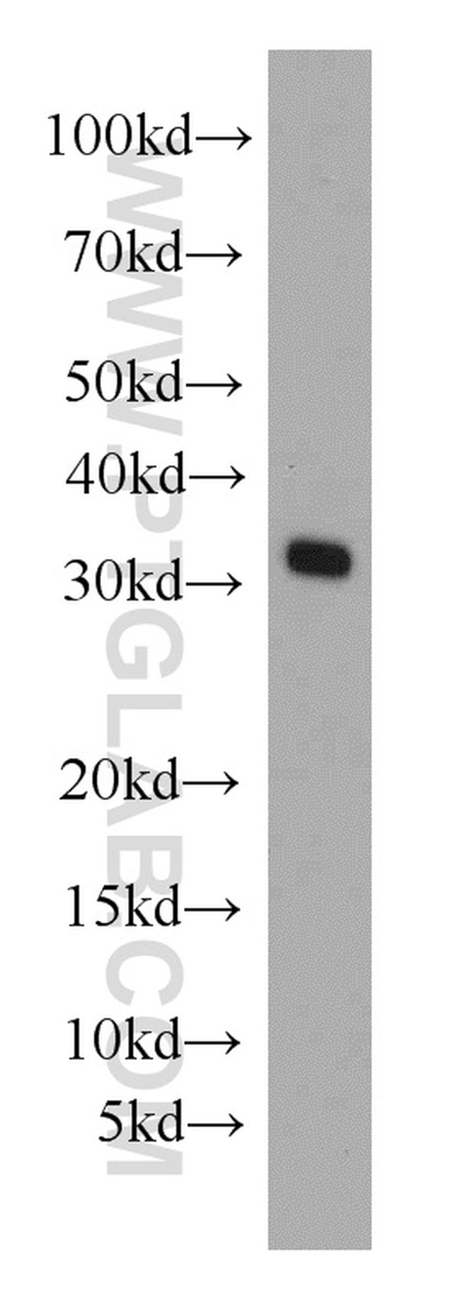 MRPL28 Antibody in Western Blot (WB)