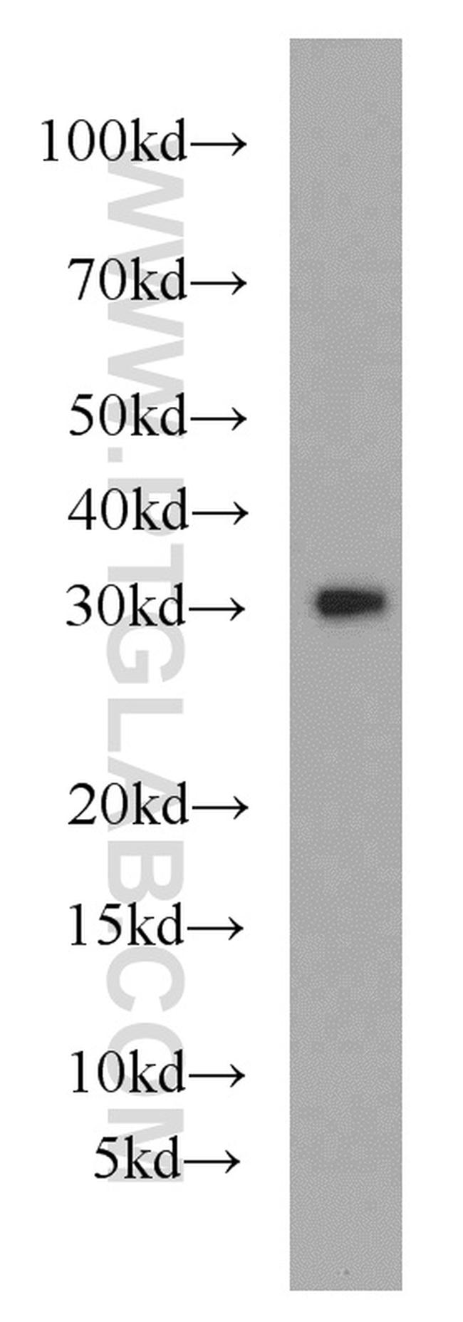 MRPL28 Antibody in Western Blot (WB)