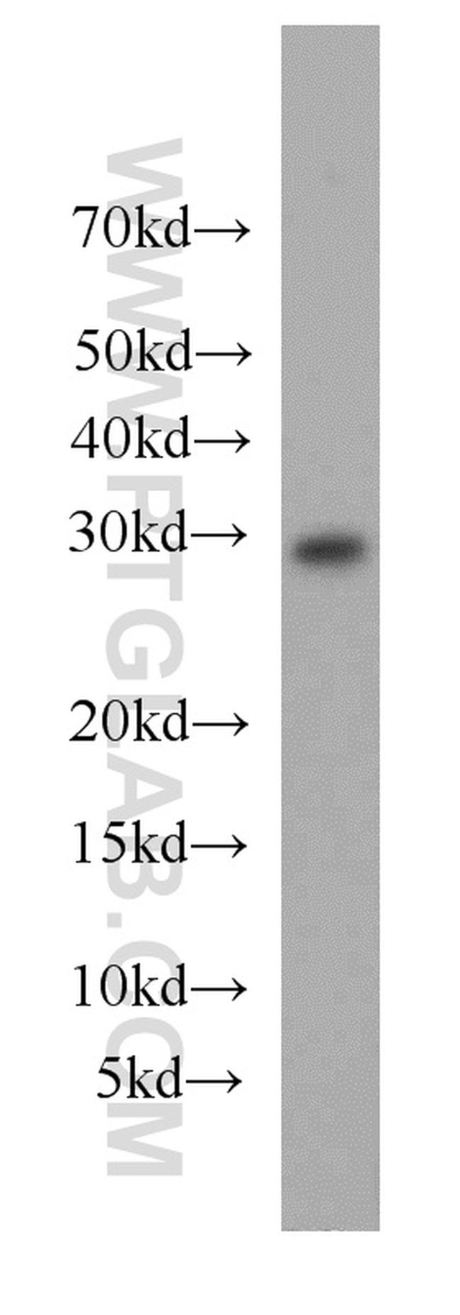 MRPL28 Antibody in Western Blot (WB)