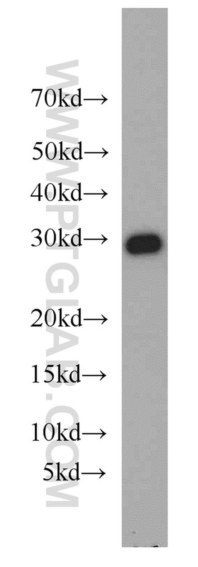 MRPL28 Antibody in Western Blot (WB)