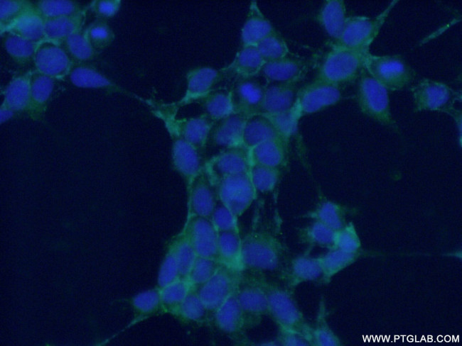 NRCAM Antibody in Immunocytochemistry (ICC/IF)