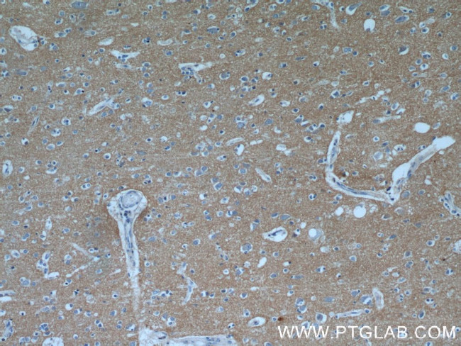 NRCAM Antibody in Immunohistochemistry (Paraffin) (IHC (P))