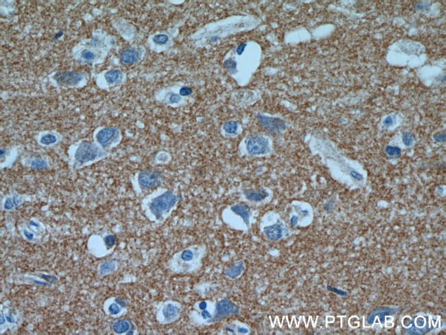 NRCAM Antibody in Immunohistochemistry (Paraffin) (IHC (P))