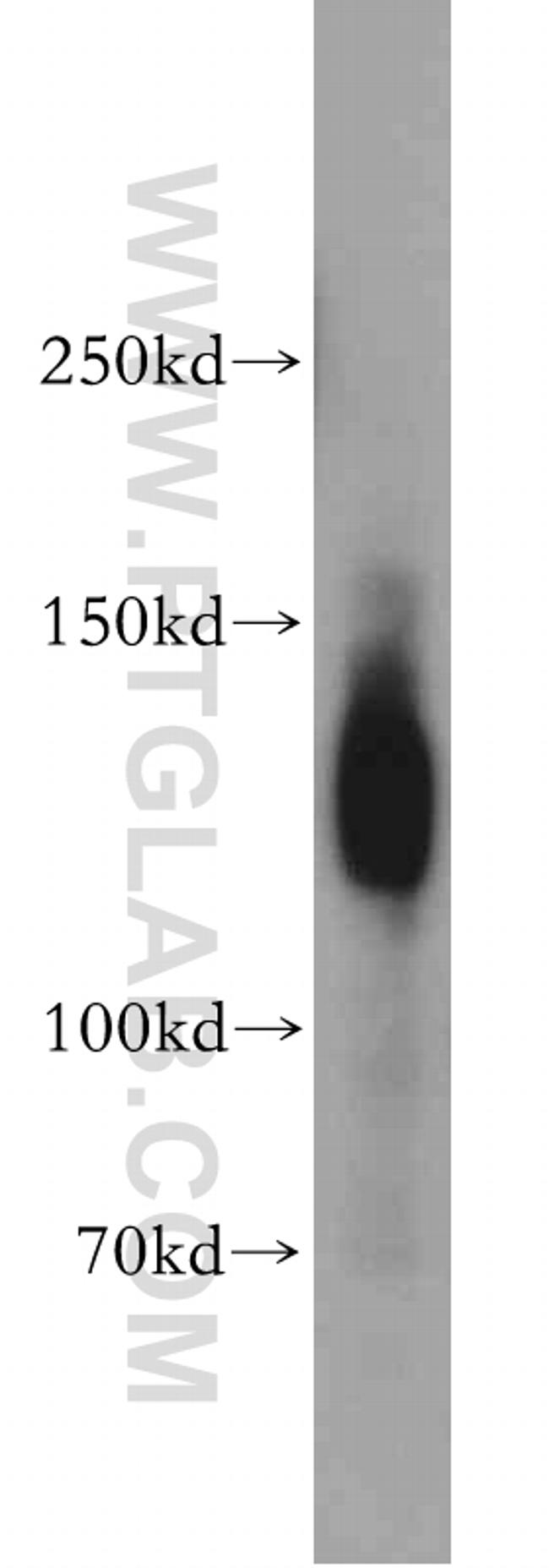 NRCAM Antibody in Western Blot (WB)