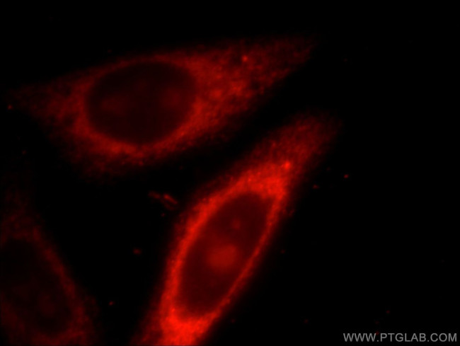 IL1RAPL1 Antibody in Immunocytochemistry (ICC/IF)