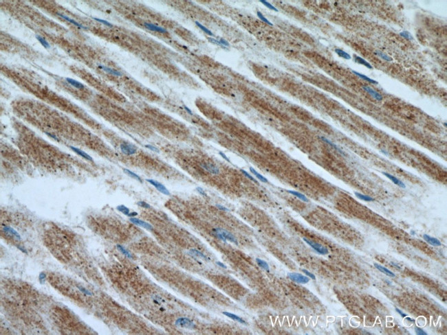 IL1RAPL1 Antibody in Immunohistochemistry (Paraffin) (IHC (P))