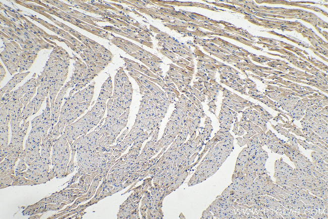 IL1RAPL1 Antibody in Immunohistochemistry (Paraffin) (IHC (P))