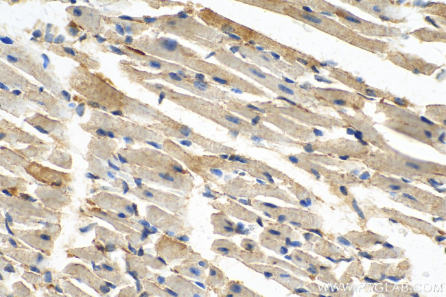 IL1RAPL1 Antibody in Immunohistochemistry (Paraffin) (IHC (P))