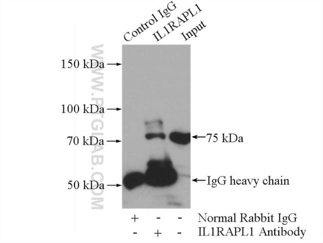 IL1RAPL1 Antibody in Immunoprecipitation (IP)