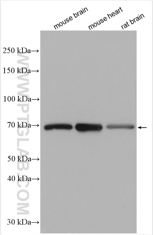 IL1RAPL1 Antibody in Western Blot (WB)