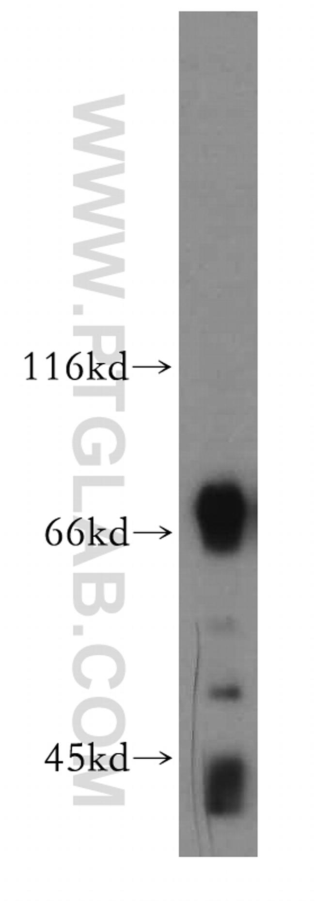 IL1RAPL1 Antibody in Western Blot (WB)