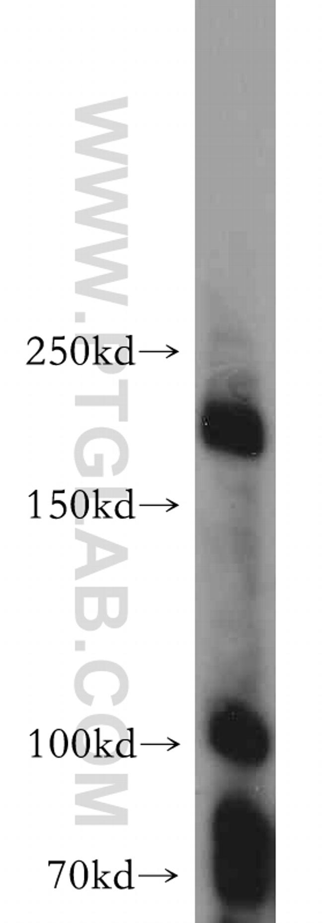 MAP3K4 Antibody in Western Blot (WB)