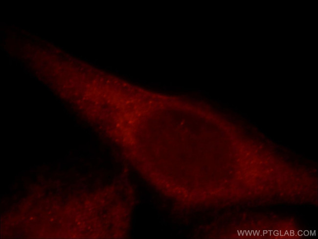 MAP3K4 Antibody in Immunocytochemistry (ICC/IF)