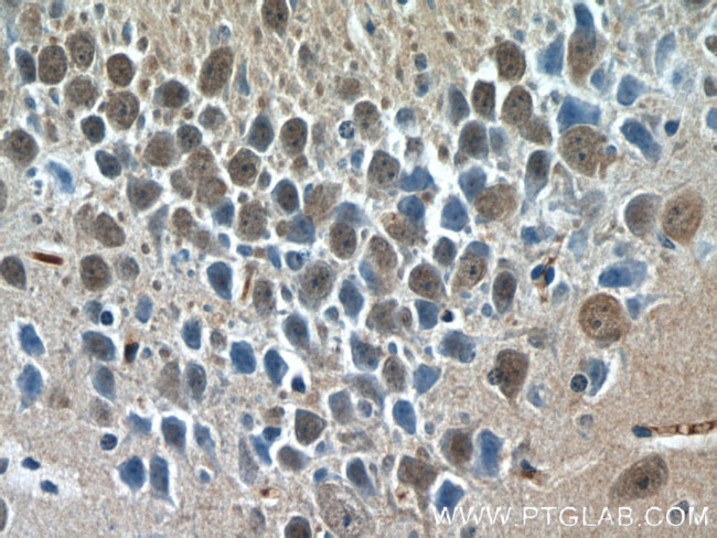 PFTK1 Antibody in Immunohistochemistry (Paraffin) (IHC (P))