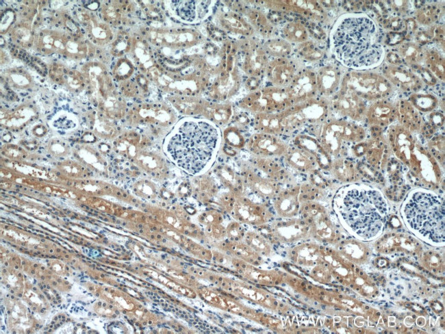 PFTK1 Antibody in Immunohistochemistry (Paraffin) (IHC (P))