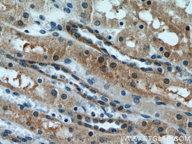 PFTK1 Antibody in Immunohistochemistry (Paraffin) (IHC (P))