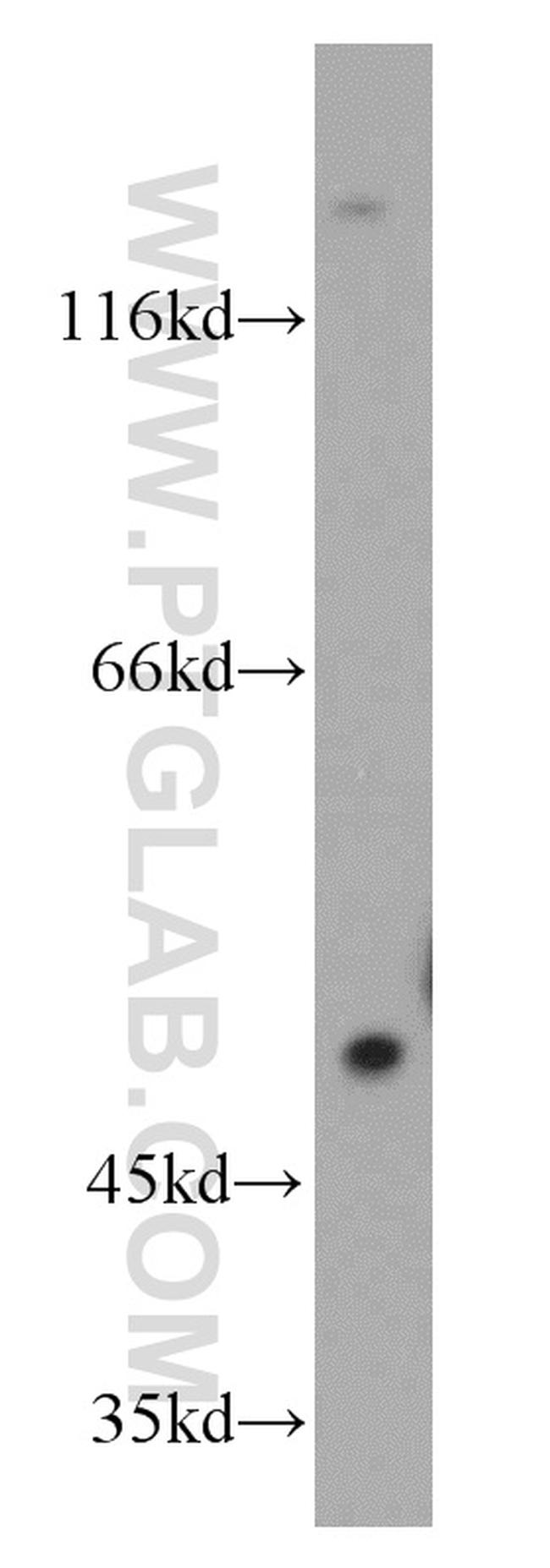 PFTK1 Antibody in Western Blot (WB)