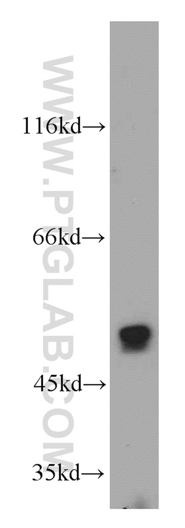 PFTK1 Antibody in Western Blot (WB)