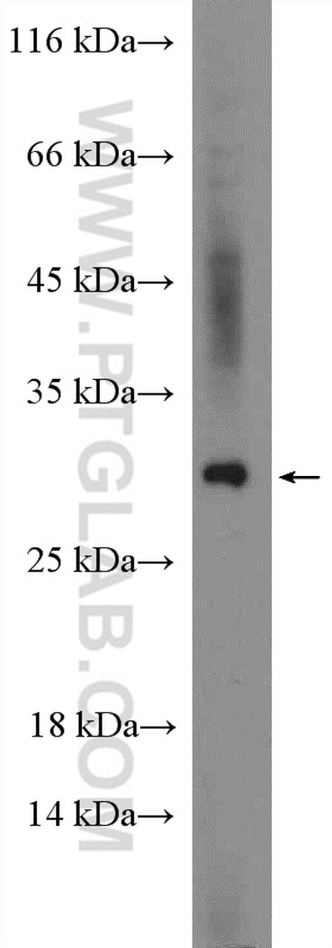 ADIPOQ Antibody in Western Blot (WB)