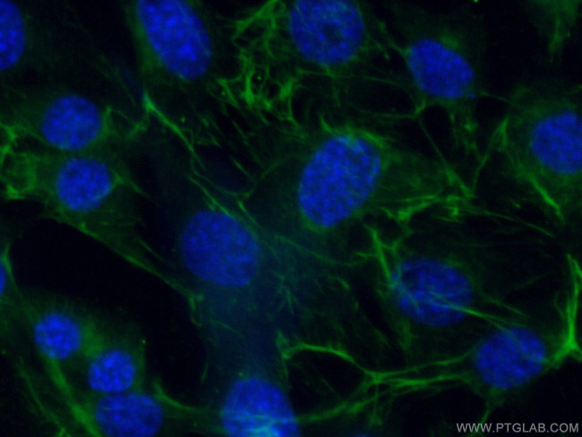 ADIPOQ Antibody in Immunocytochemistry (ICC/IF)