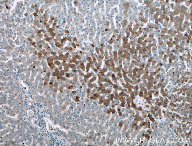 ADIPOQ Antibody in Immunohistochemistry (Paraffin) (IHC (P))