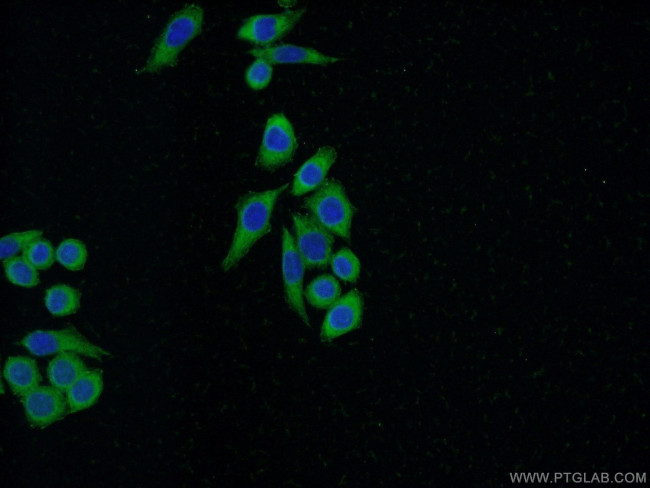 FHL2 Antibody in Immunocytochemistry (ICC/IF)