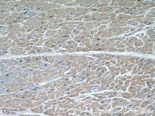 FHL2 Antibody in Immunohistochemistry (Paraffin) (IHC (P))