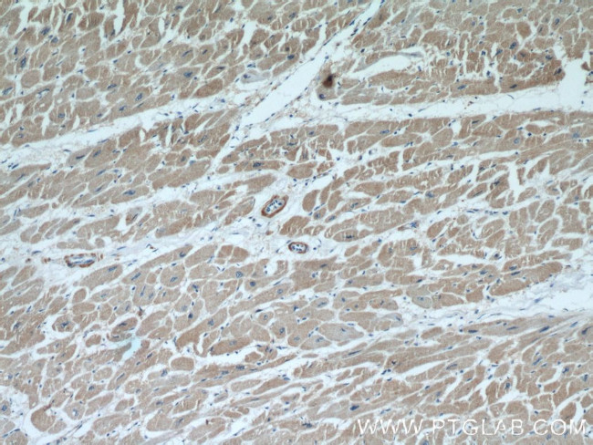 FHL2 Antibody in Immunohistochemistry (Paraffin) (IHC (P))