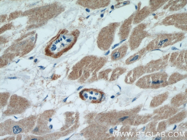 FHL2 Antibody in Immunohistochemistry (Paraffin) (IHC (P))