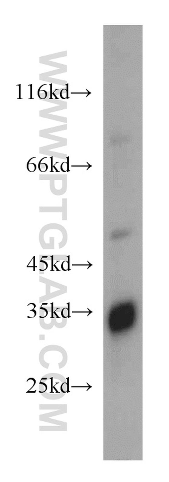 FHL2 Antibody in Western Blot (WB)