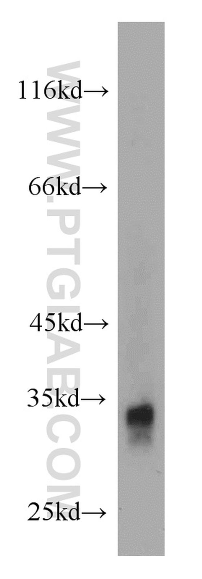 FHL2 Antibody in Western Blot (WB)