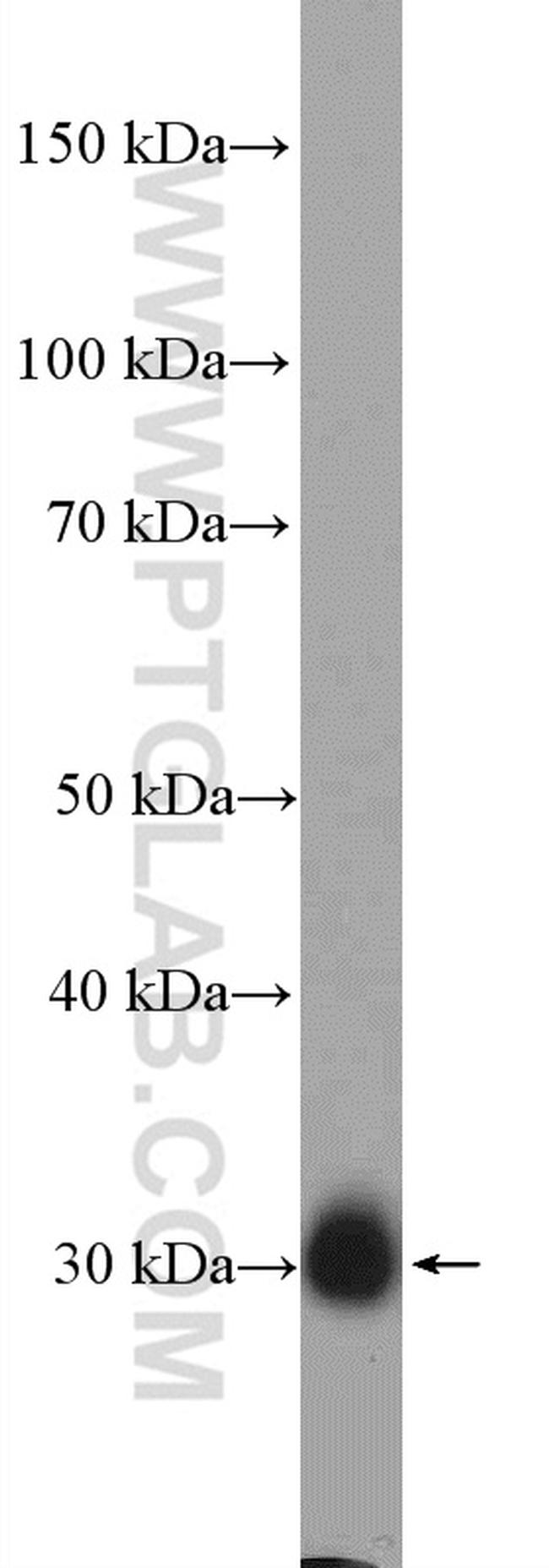 FHL2 Antibody in Western Blot (WB)