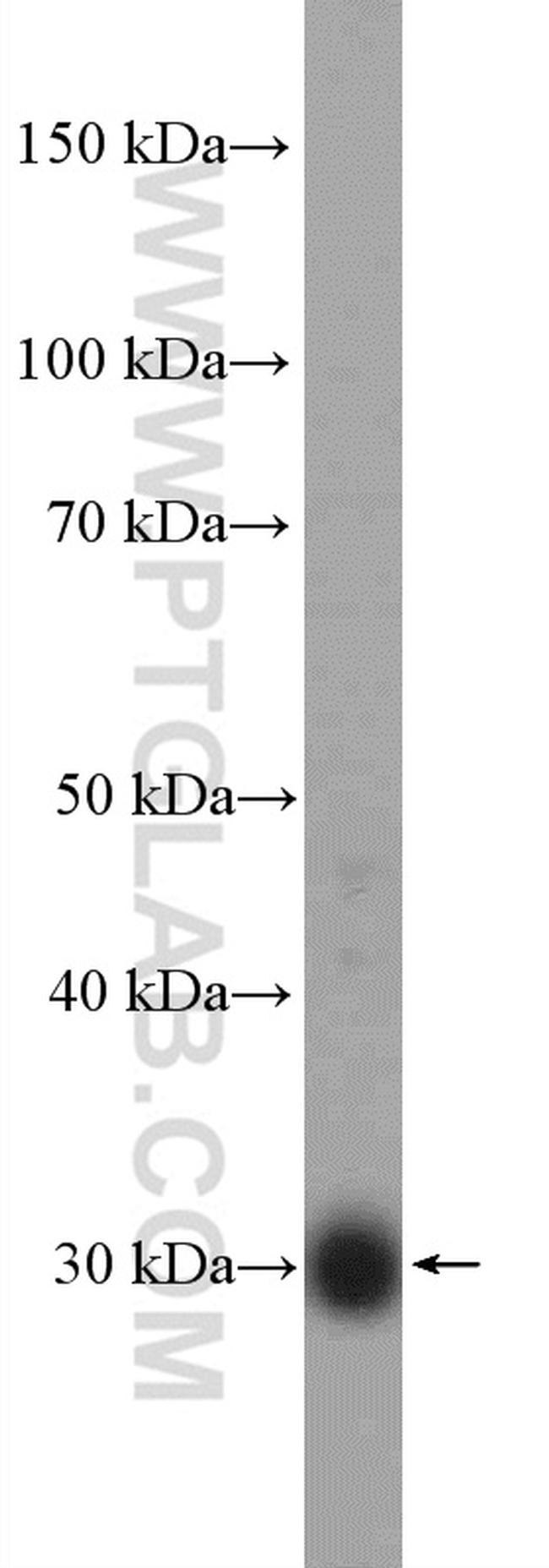 FHL2 Antibody in Western Blot (WB)