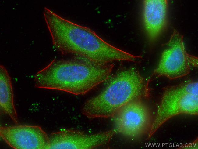 TMED9 Antibody in Immunocytochemistry (ICC/IF)