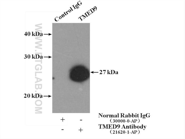 TMED9 Antibody in Immunoprecipitation (IP)