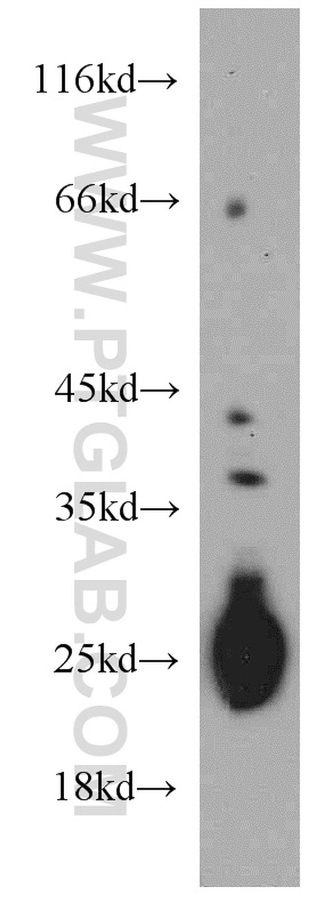 TMED9 Antibody in Western Blot (WB)