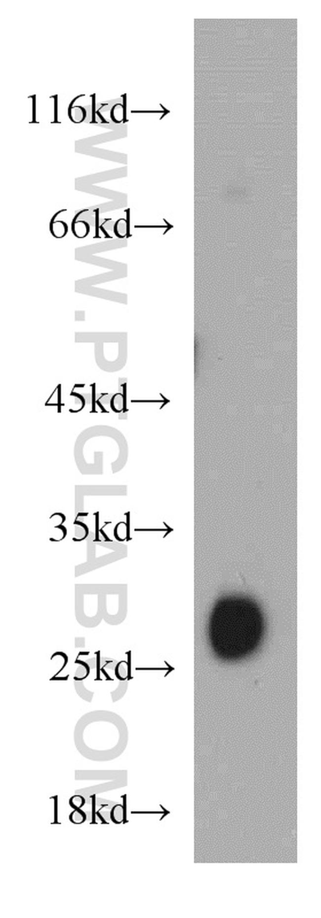 TMED9 Antibody in Western Blot (WB)