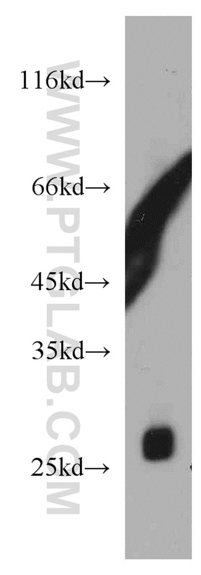 TMED9 Antibody in Western Blot (WB)