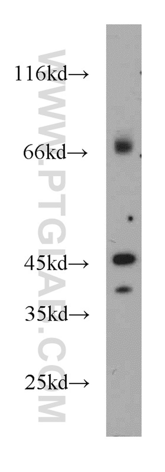 GPBP1 Antibody in Western Blot (WB)