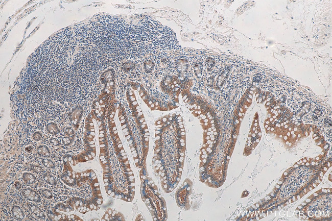 GPBP1 Antibody in Immunohistochemistry (Paraffin) (IHC (P))