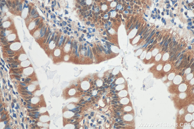 GPBP1 Antibody in Immunohistochemistry (Paraffin) (IHC (P))