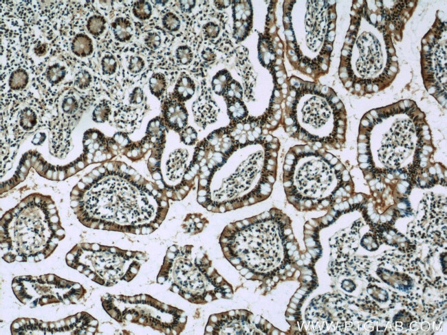 GPBP1 Antibody in Immunohistochemistry (Paraffin) (IHC (P))