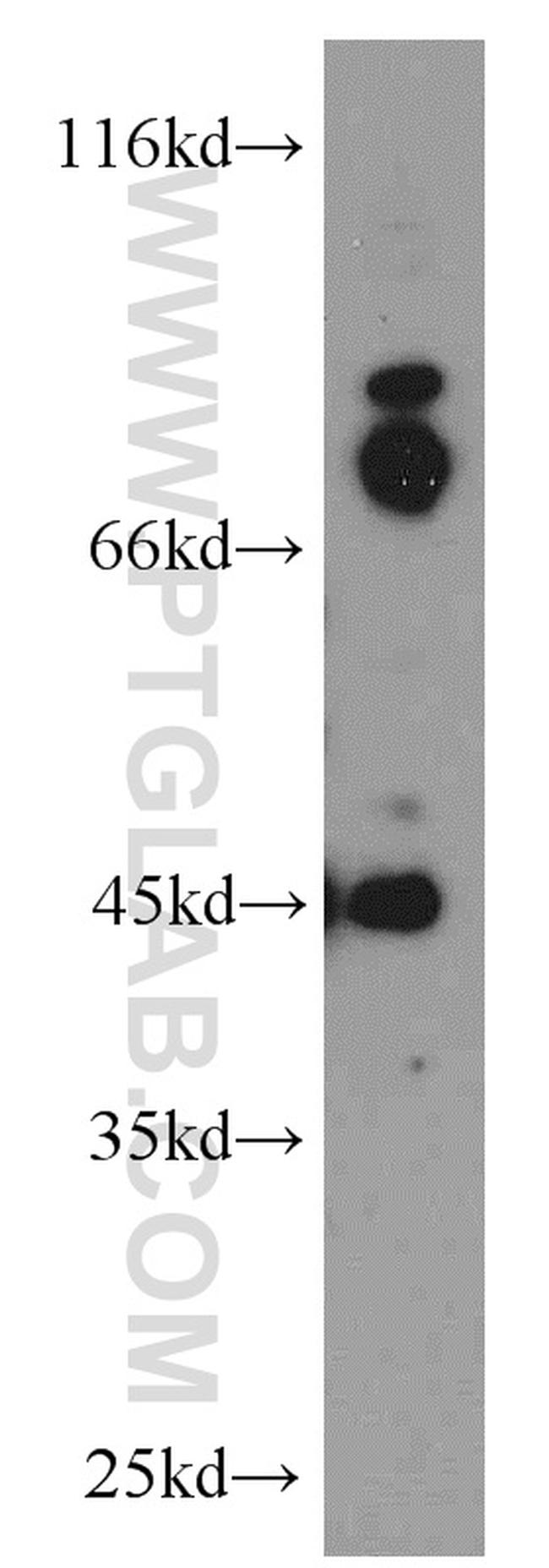 GPBP1 Antibody in Western Blot (WB)