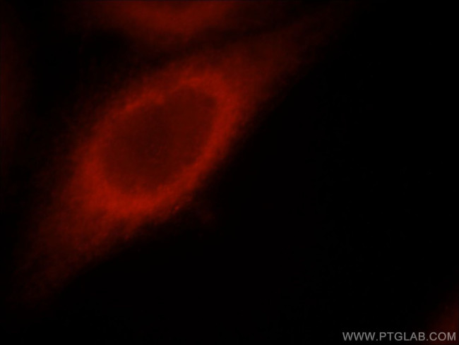 STRN Antibody in Immunocytochemistry (ICC/IF)