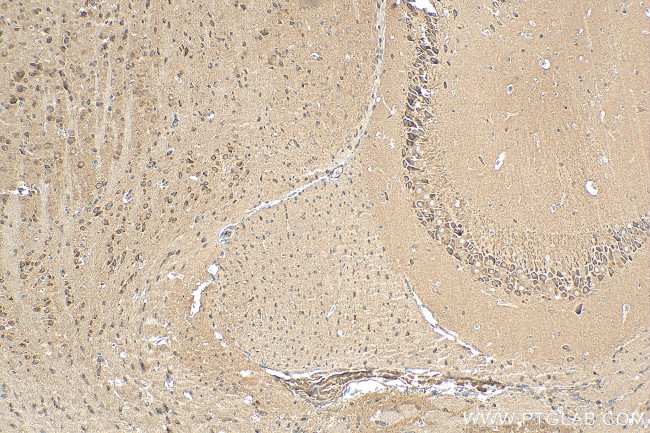 STRN Antibody in Immunohistochemistry (Paraffin) (IHC (P))