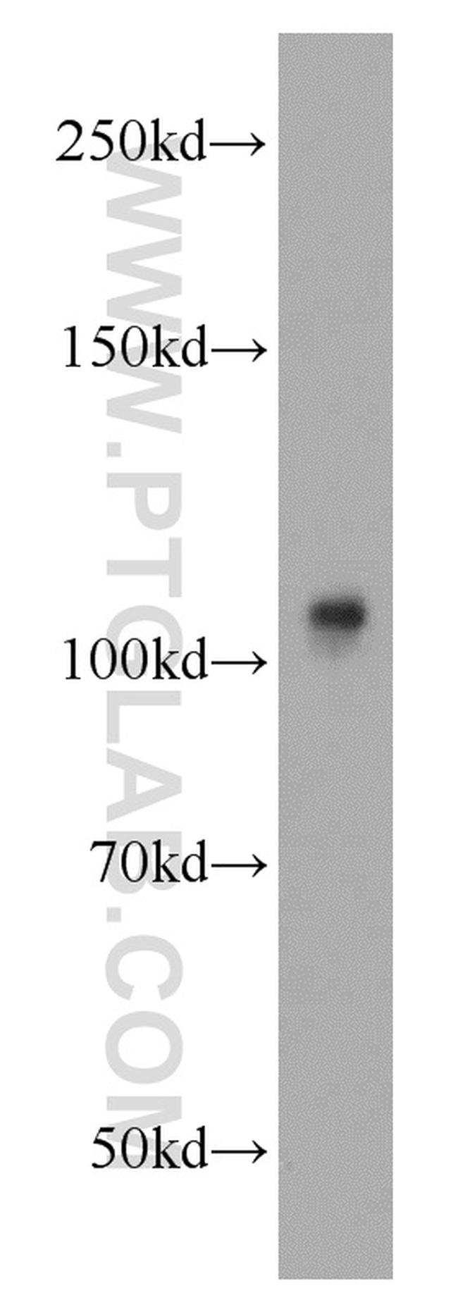 STRN Antibody in Western Blot (WB)