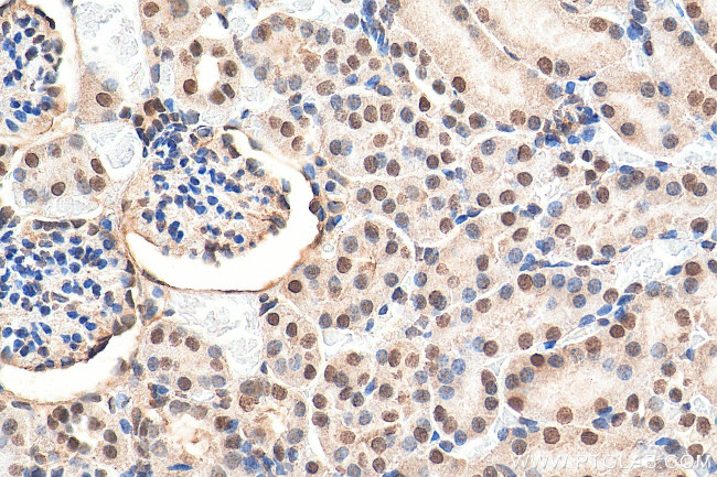 RNF20 Antibody in Immunohistochemistry (Paraffin) (IHC (P))